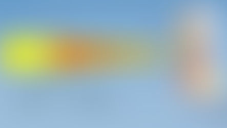 Understanding Refractive Surprise with Multifocal IOLs