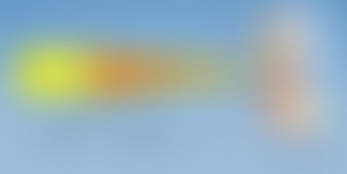 How near vision can be compromised with a multifocal IOL