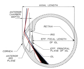 Image source: J Cataract Refract Surg 2012; 38:1251–1265
