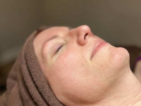 Dermaplaning vs. Microdermabrasion: Which Exfoliation Treatment Is Right for You?