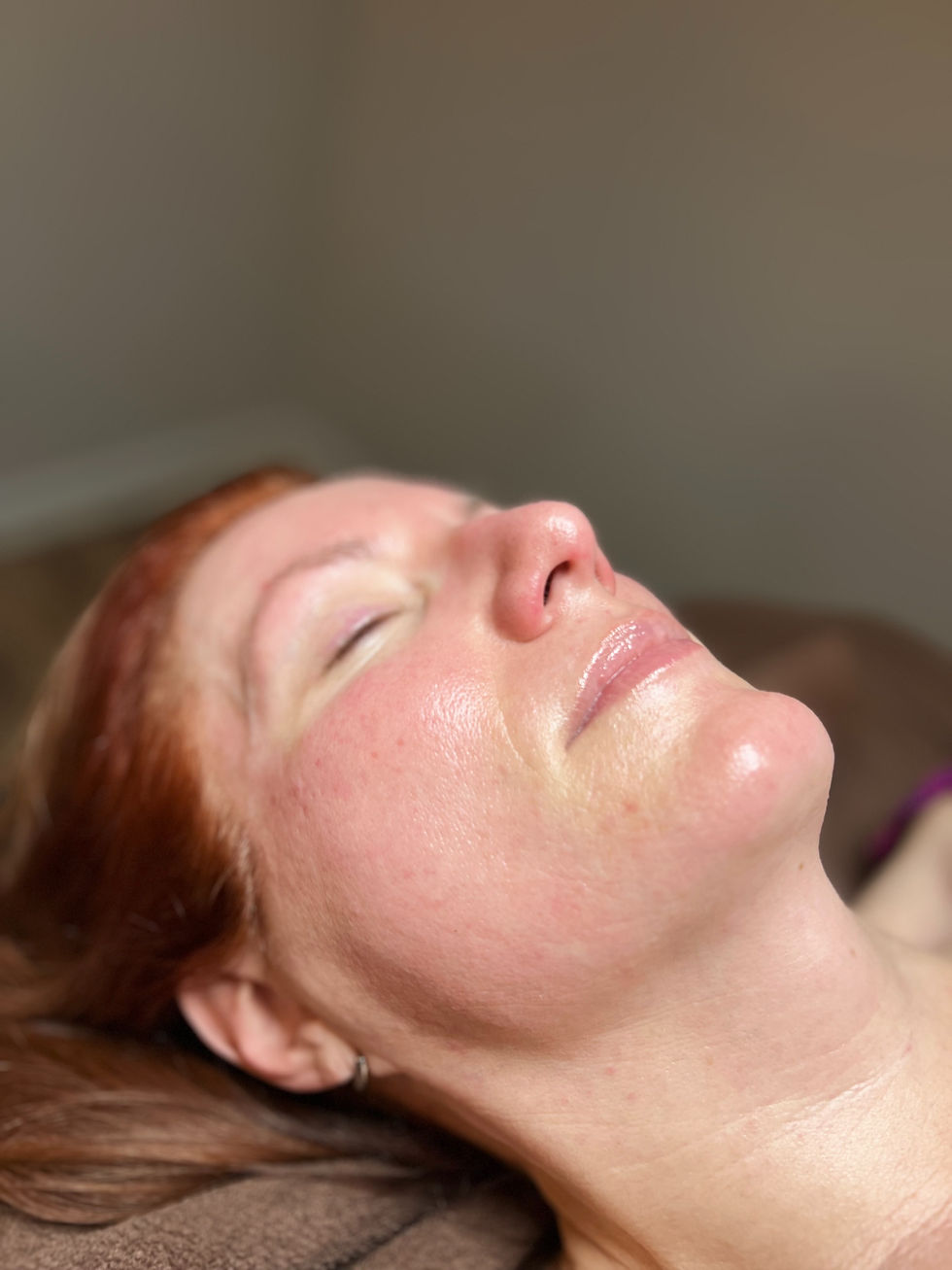 AFTER DERMAPLANE