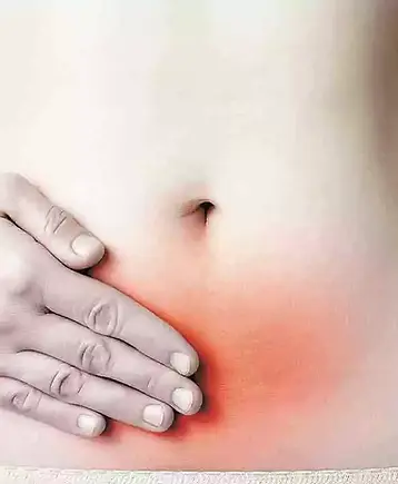 ENDOMETRIOSE.webp