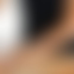 Close view of a therapist providing a back massage; illustrative stock photograph
