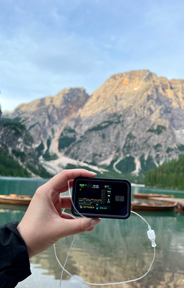 Kurz über die aktuellen LoopSysteme