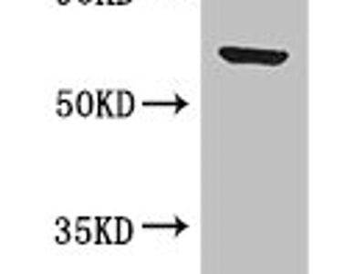 BTRC Antibody