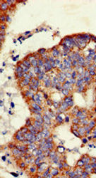 GLB1 Antibody