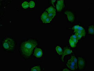 Thumbnail: ITGA5 Antibody