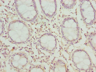 Thumbnail: CLYBL Antibody