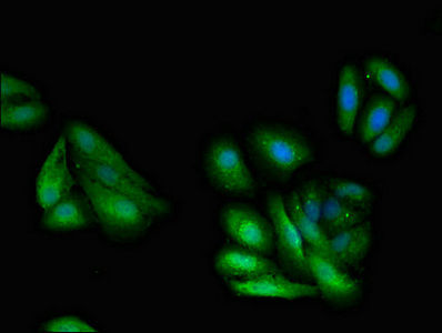 Thumbnail: GNB1 Antibody