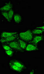 Thumbnail: TPH2 Antibody