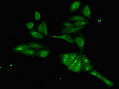 Thumbnail: FOXI1 Antibody