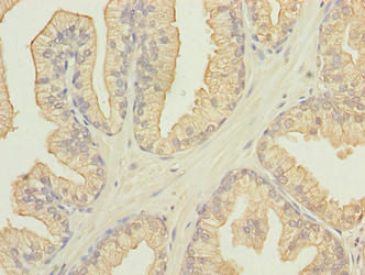 Thumbnail: FAM78A Antibody