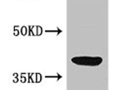 ADH5 Antibody