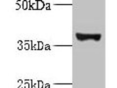 UBLCP1 Antibody