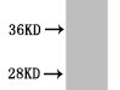 Acetyl-Histone H2B type 1-B(K20)Antibody