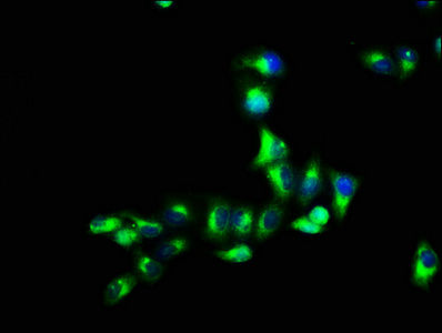 Thumbnail: GPR12 Antibody