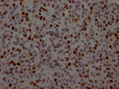 Thumbnail: TP53 Antibody