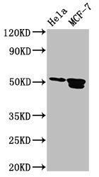 TFAP2B Antibody