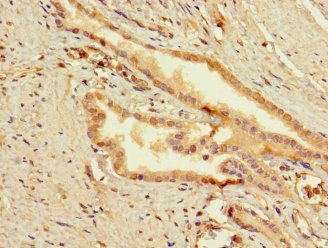 Thumbnail: SLC25A10 Antibody