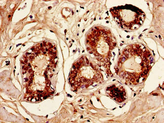 Thumbnail: CCL2 Antibody