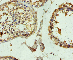 Thumbnail: TUBB3 Antibody