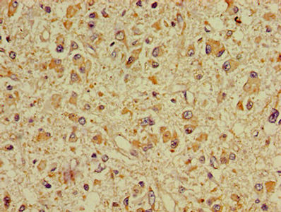 Thumbnail: DPYSL2 Antibody