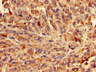 Thumbnail: BLZF1 Antibody