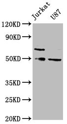 Thumbnail: SH3BP5 Antibody