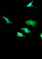 Thumbnail: TPT1 Antibody