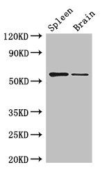 D2HGDH Antibody