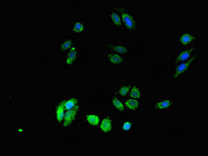 Thumbnail: DPM1 Antibody