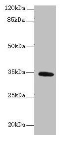 SETD9 Antibody