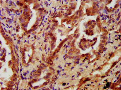 Thumbnail: PRKCH Antibody