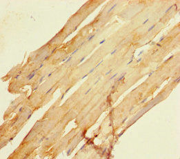 Thumbnail: SCAMP3 Antibody