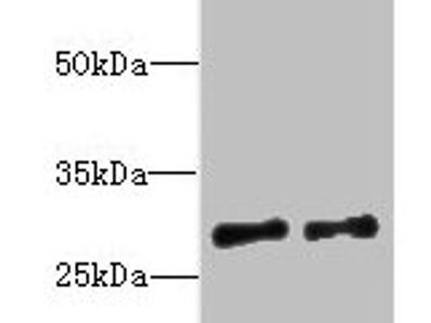 TEX47 Antibody