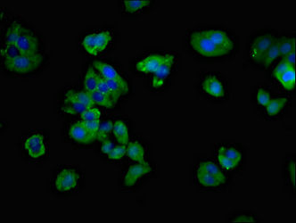 Thumbnail: CD3G Antibody