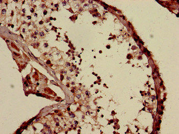 Thumbnail: COQ6 Antibody