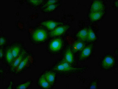 Thumbnail: DRD1 Antibody