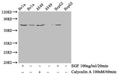Phospho-PXN (Y118) Antibody