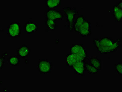 Thumbnail: SWI5 Antibody