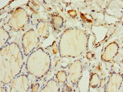 Thumbnail: OSGIN2 Antibody