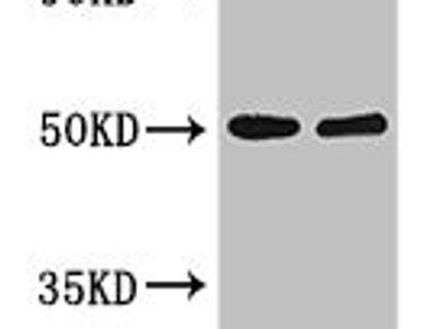 KIR3DL1 Antibody