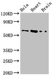 Thumbnail: BAIAP2 Antibody