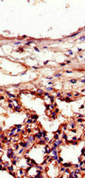 ICAM1 Antibody