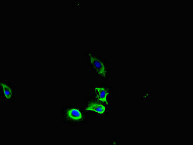 Thumbnail: PDGFRA Antibody