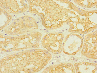 Thumbnail: ASIC3 Antibody