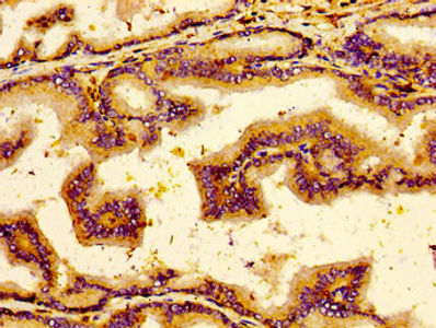 Thumbnail: NTSR2 Antibody