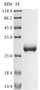 Recombinant Human Basement membrane-specific heparan sulfate proteoglycan core p