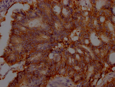 Thumbnail: EPCAM Antibody