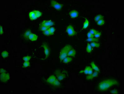 Thumbnail: CD27 Antibody